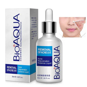 Bioaqua Anti-Acne Serum Removal Of Acne Essence Liquid 30ML BQY0726 - Image 2