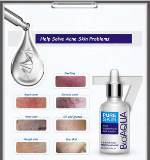 Bioaqua Anti-Acne Serum Removal Of Acne Essence Liquid 30ML BQY0726 - Image 3